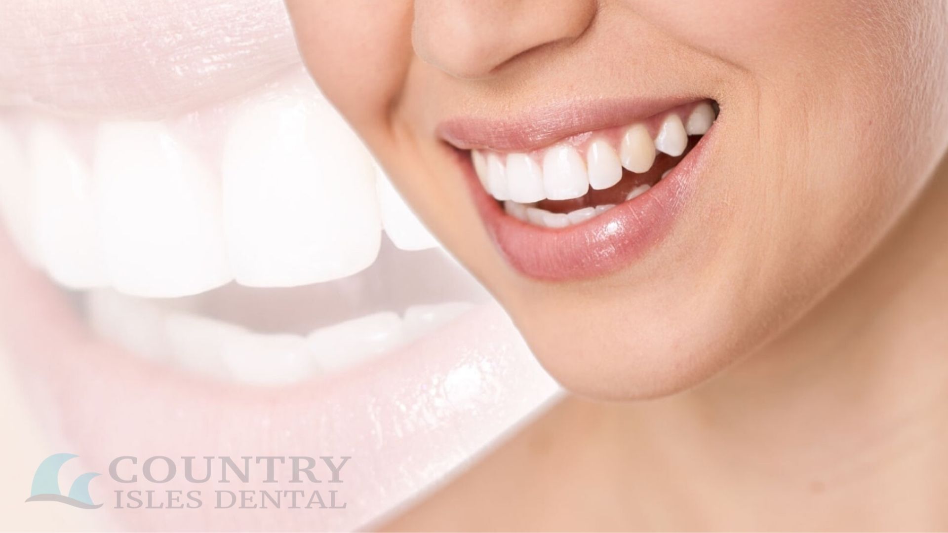 Everything You Should Know About Cosmetic Dentistry